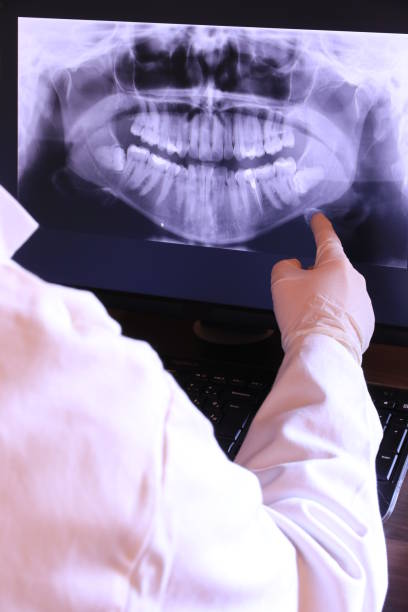 Best Emergency Denture Repair in Peoria Heights, IL